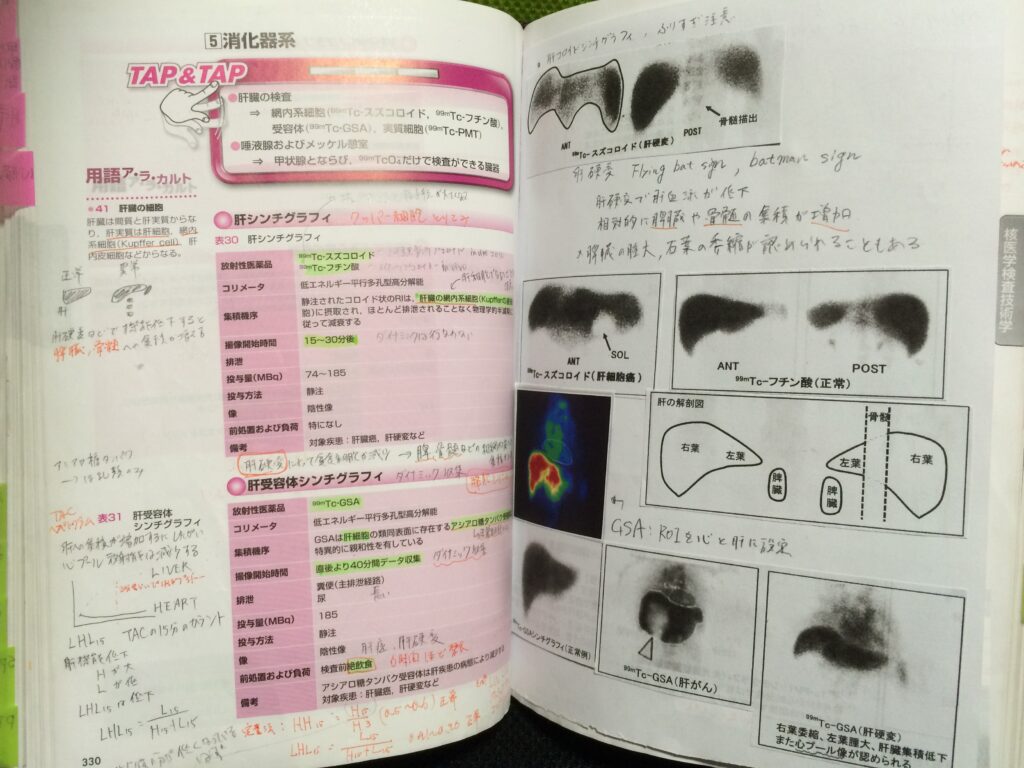 簡単 超有料級 放射線技師国家試験 勉強法 やり方次第で楽勝合格 放射線技師f太郎のブログ